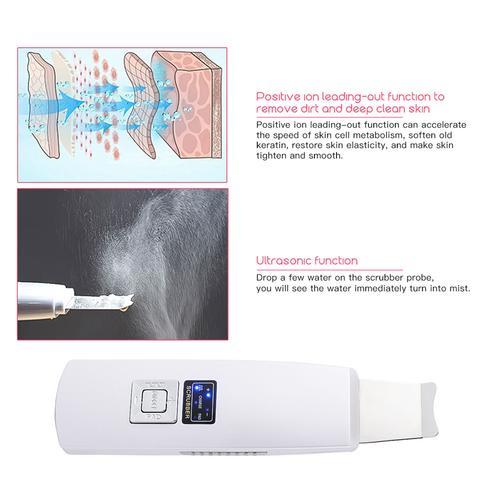 Ultrasonic Skin Scrubber & Face Cleanser | Blackhead Acne Removal Facial Spa Tool